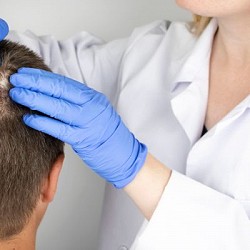 Solutions for Hair Loss on One Side: From Diagnosis to Treatment